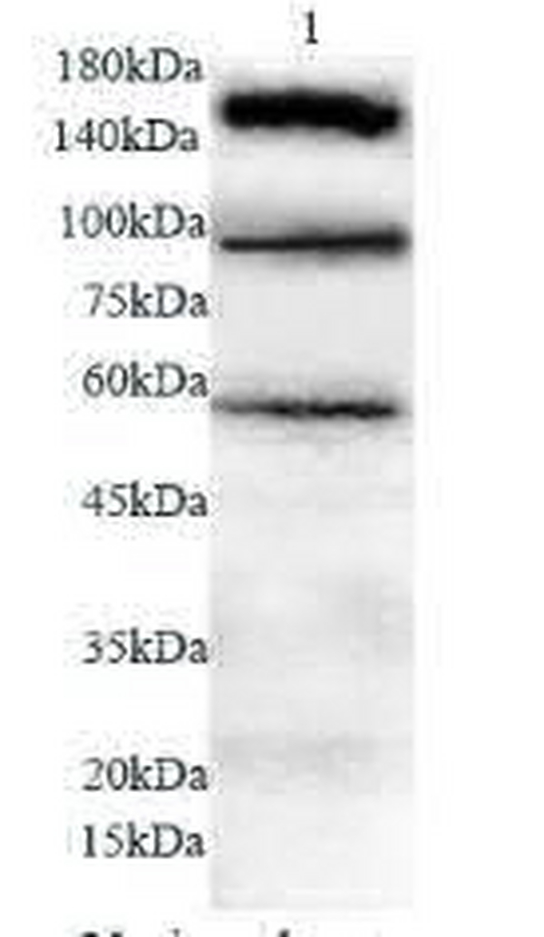 Anti ISR polyclonal antibody
