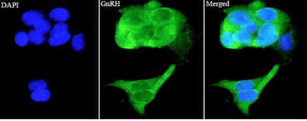 Anti GnRH1 polyclonal antibody