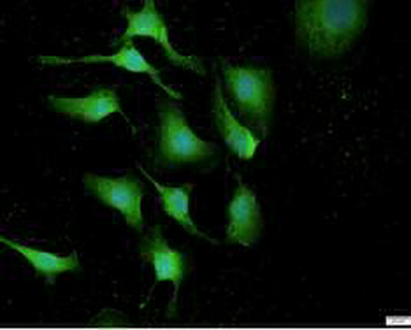 Anti PON3 polyclonal antibody