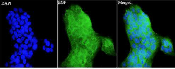 Anti EGF polyclonal antibody