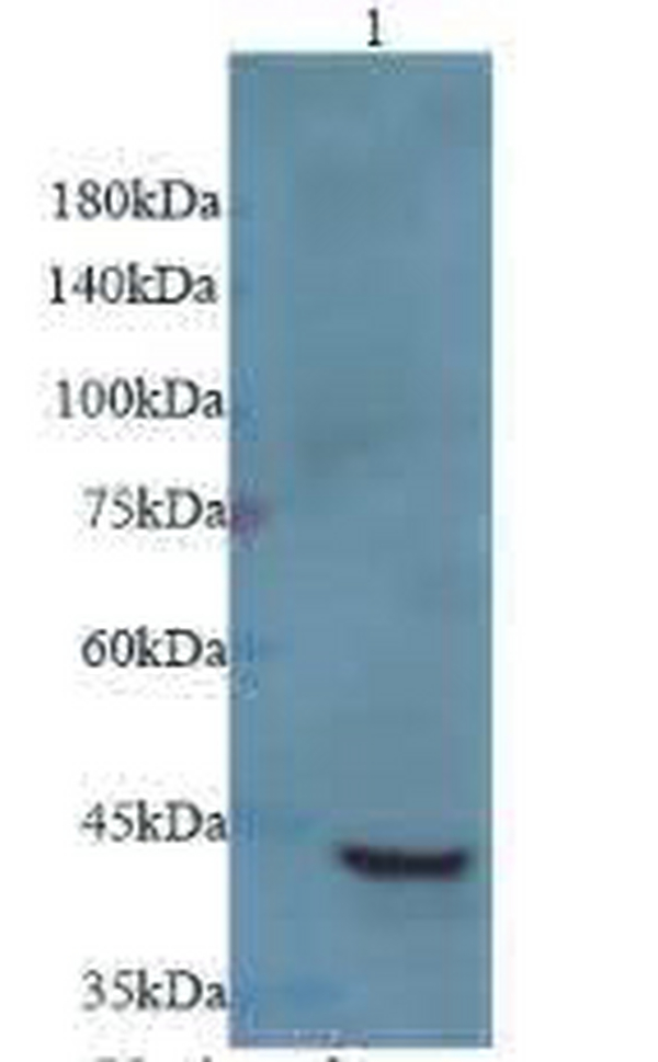 Anti RRM2B polyclonal antibody