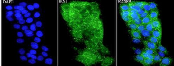 Anti IRS1 polyclonal antibody