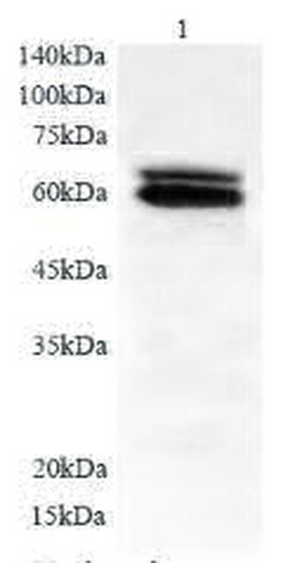 Anti SLC39A6 polyclonal antibody