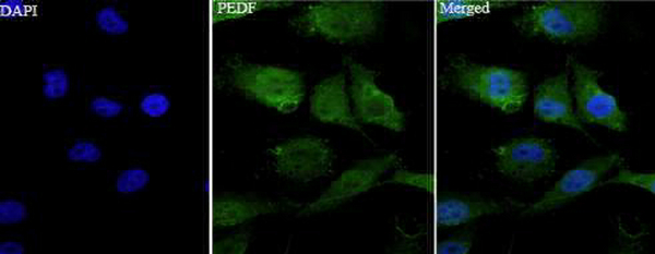 Anti PEDF polyclonal antibody