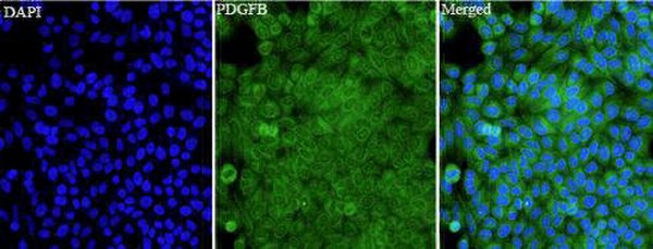 Anti PDGFB polyclonal antibody