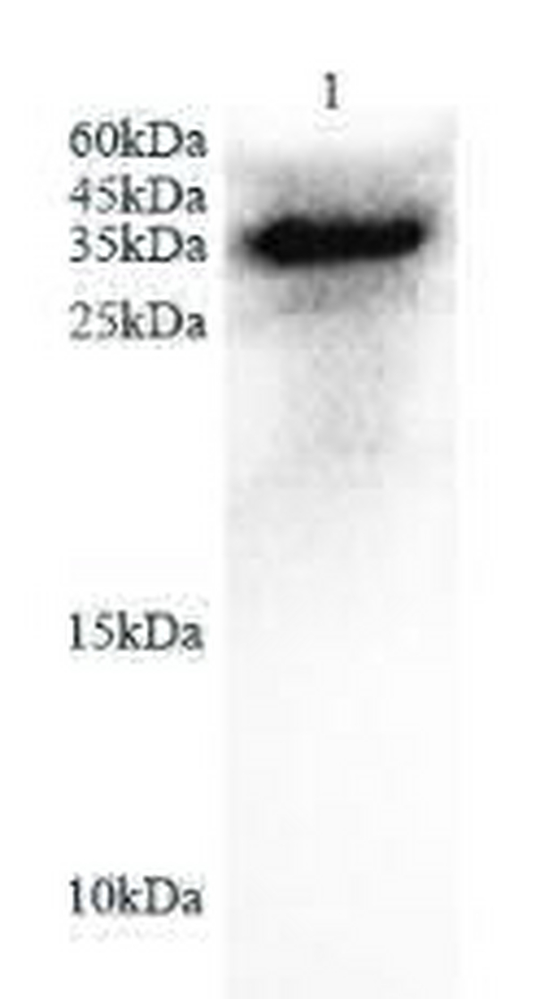 Anti IL6 polyclonal antibody