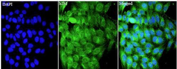 Anti B2M polyclonal antibody