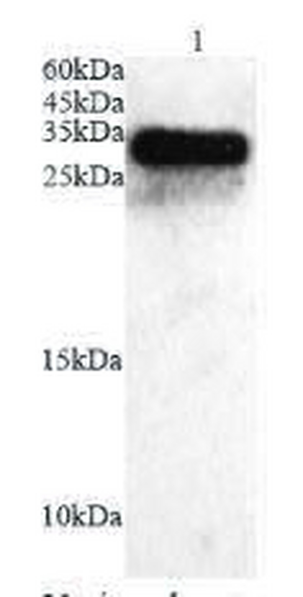 Anti ICOS polyclonal antibody