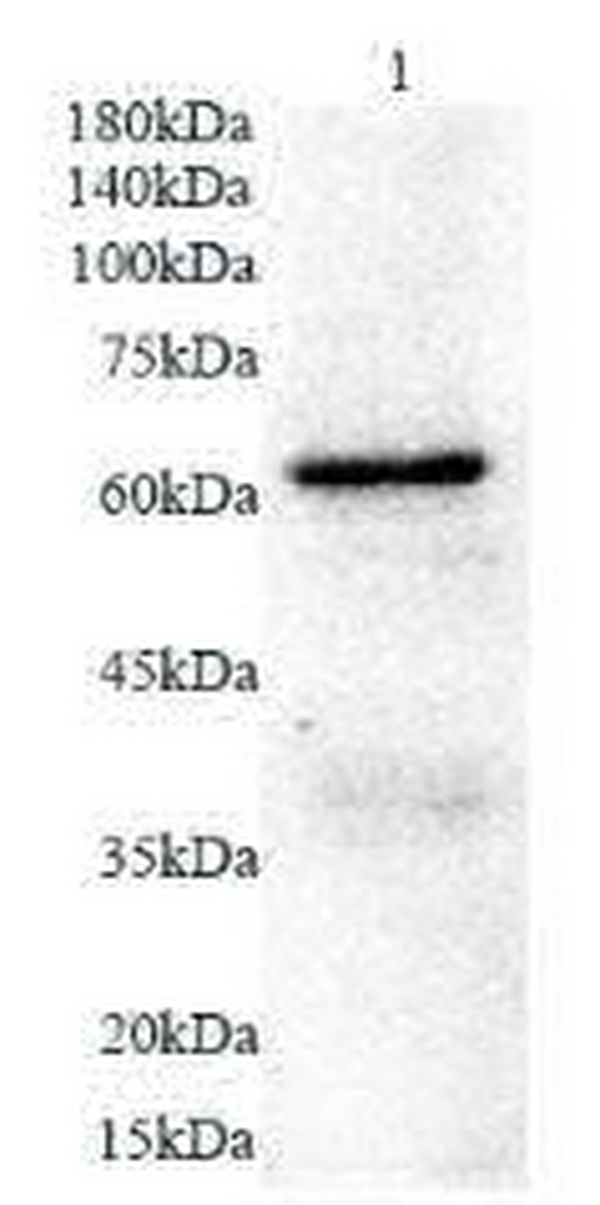 Anti GAD65 polyclonal antibody