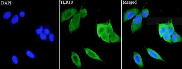 Anti TLR10 polyclonal antibody