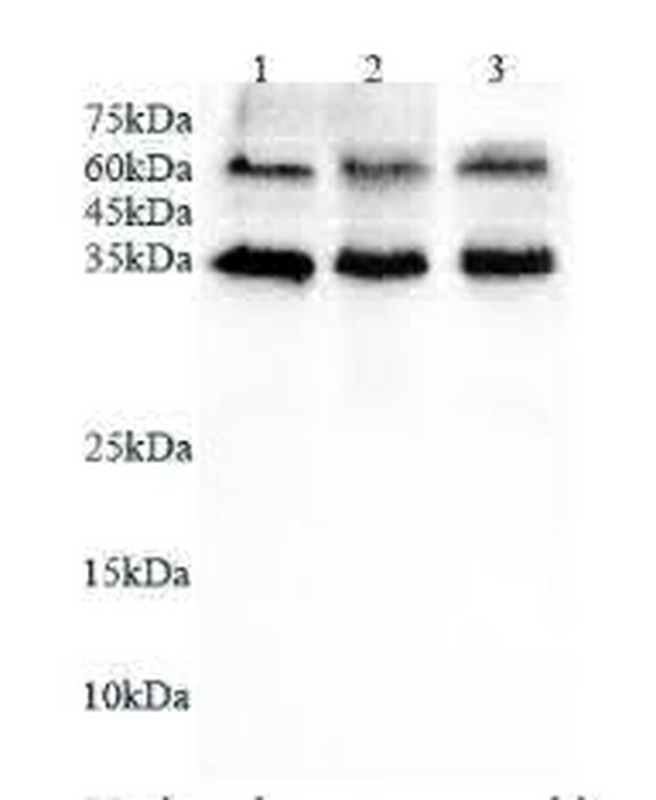 Anti CD16b polyclonal antibody