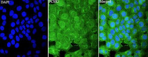 Anti PCSK1 polyclonal antibody