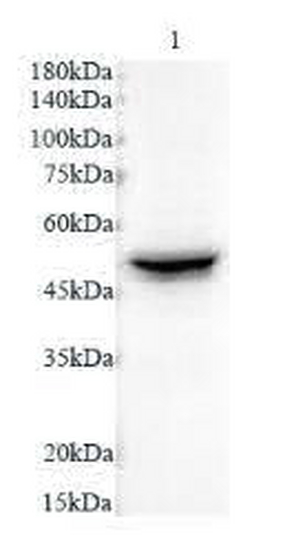 Anti CK-8 polyclonal antibody