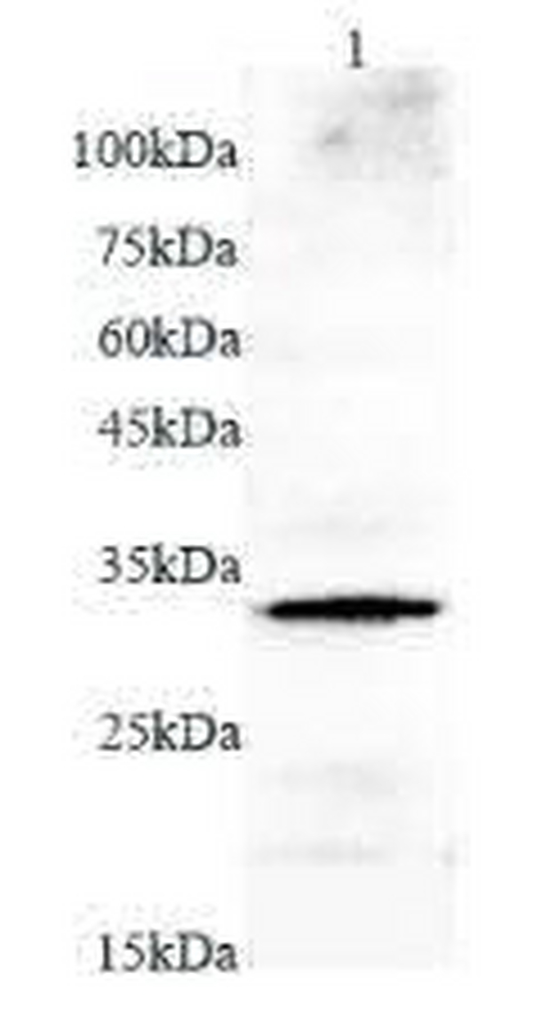Anti MMP7 polyclonal antibody