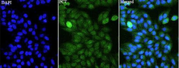 Anti CALCR polyclonal antibody