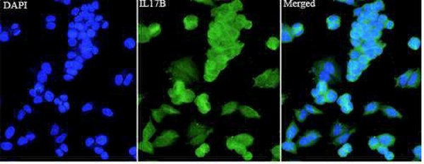 Anti IL17B polyclonal antibody