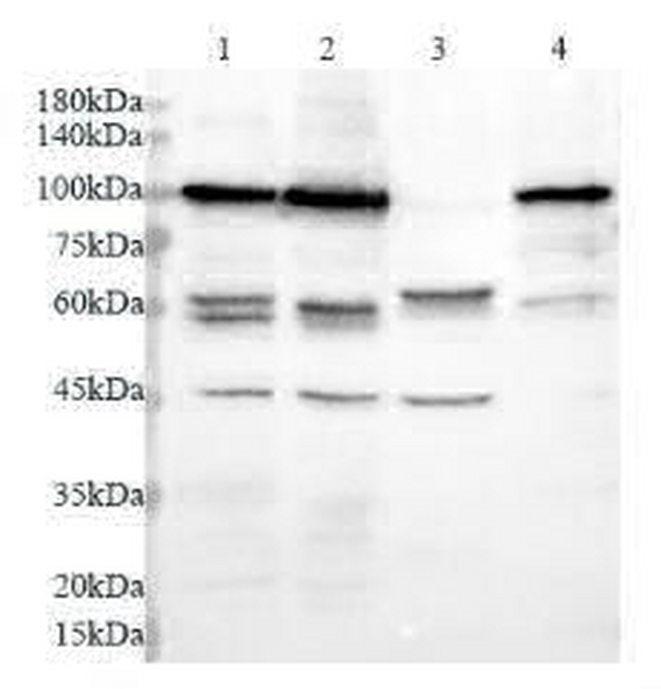 Anti NSUN2 polyclonal antibody