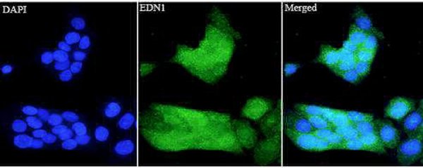 Anti EDN1 polyclonal antibody