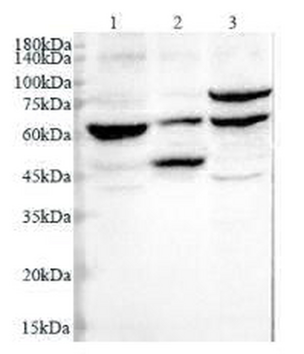 Anti CTSD polyclonal antibody
