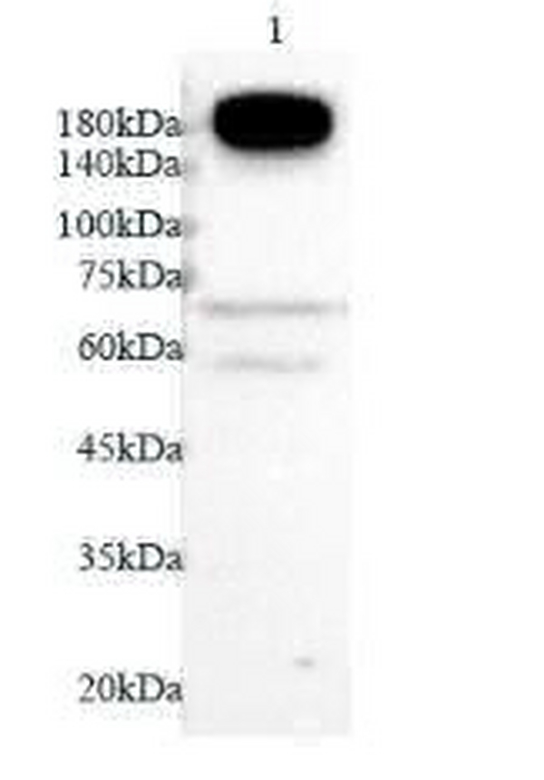 Anti CD11a polyclonal antibody
