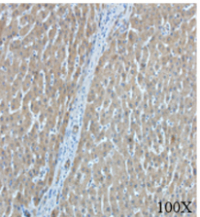 Anti AFP mouse monoclonal antibody