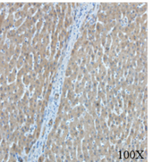 Anti AFP mouse monoclonal antibody