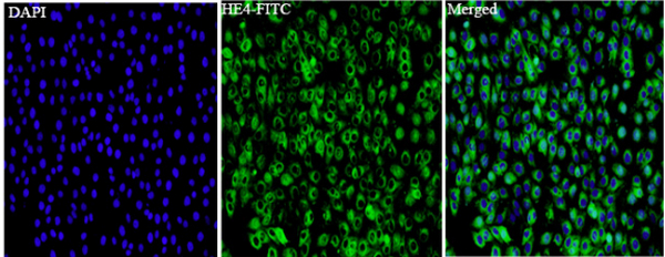 Anti HE4 mouse monoclonal antibody