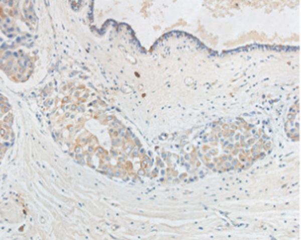 Anti TNF α mouse monoclonal antibody