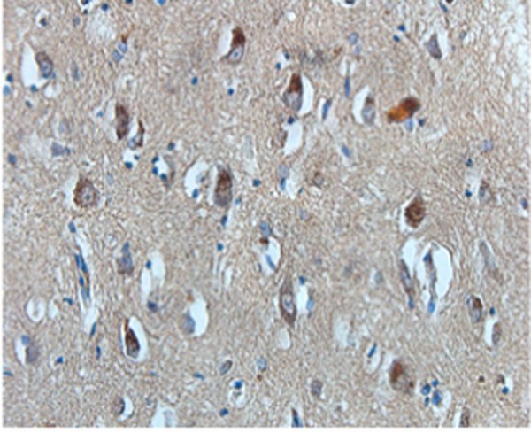 Anti VEGF mouse monoclonal antibody