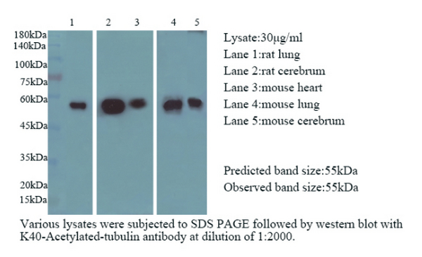 Anti K40-Acetylated-tubulin mouse monoclonal antibody