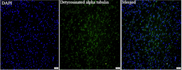 Anti Detyrosinated alpha tubulin mouse monoclonal antibody