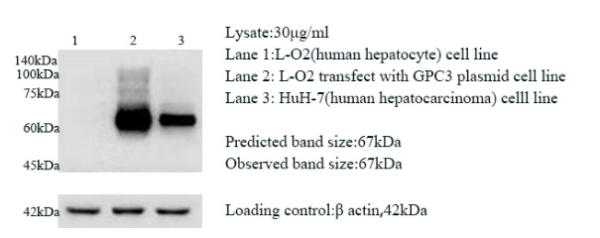 Anti Glypican-3 mouse monoclonal antibody