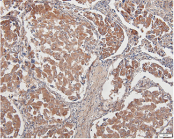 Anti PDL1 mouse monoclonal antibody