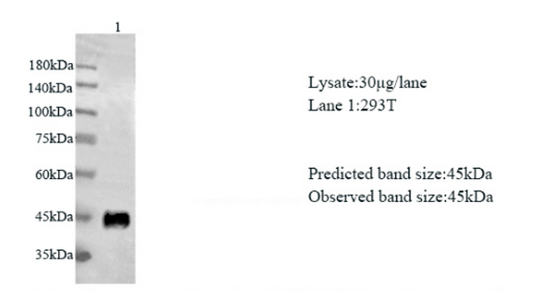 Anti GP73 mouse monoclonal antibody