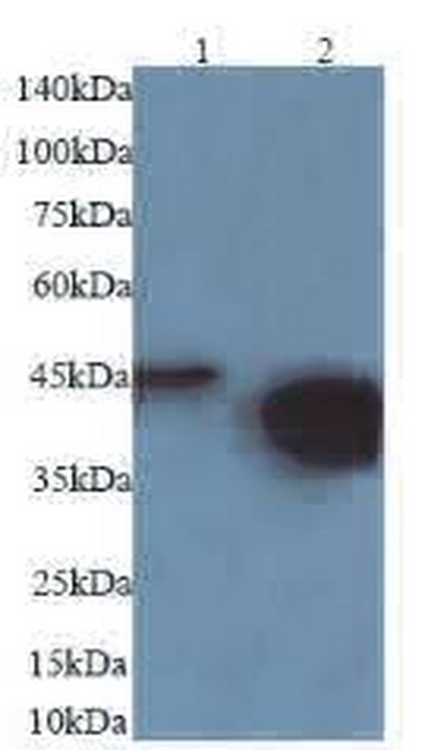 Anti CK19-Cyfra21-1 mouse monoclonal antibody