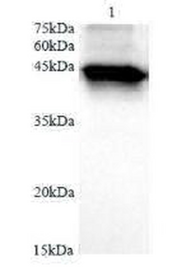 Anti CK19 mouse monoclonal antibody