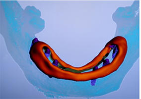 3png