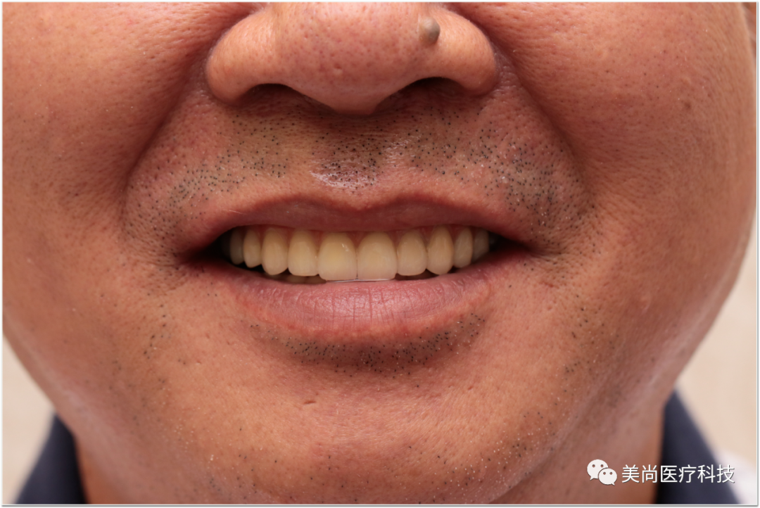 微信图片_20210315143158.png