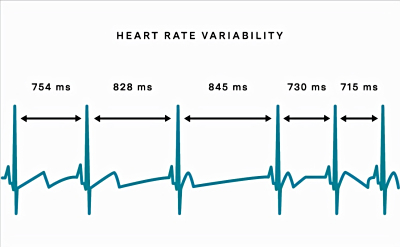 心率变异性（HRV）：揭示心脏健康的神秘指标