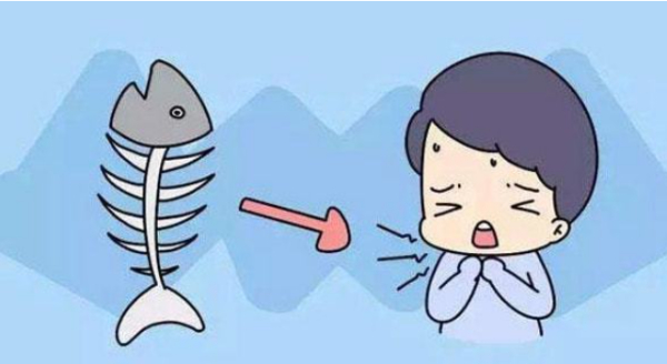 吃鱼被鱼刺卡住了，喝醋有用么？应该如何处理？