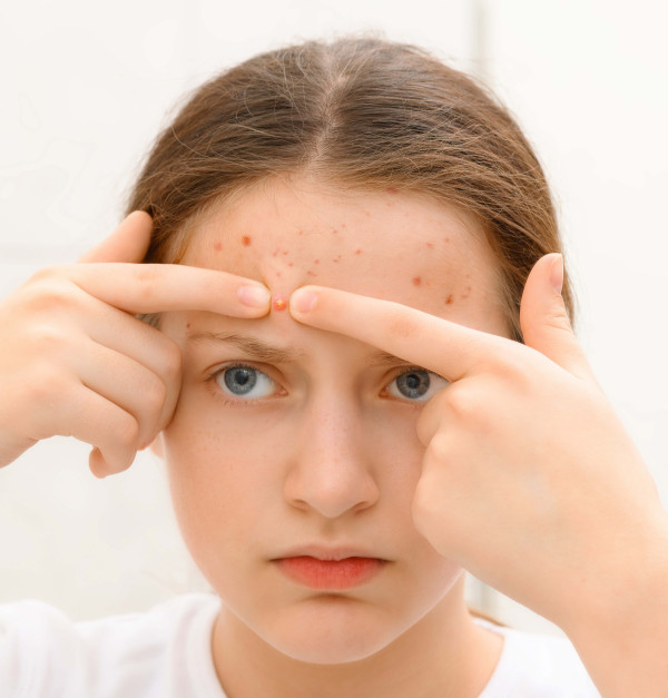 天玺硬核祛痘矩阵，瞄准千亿功效护肤市场！