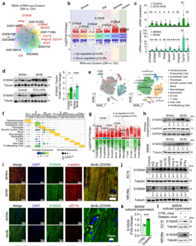JCRQ1（IF/10）：高糖高脂刺激巨噬细胞（RAW 264.7、THP-1、BMDM）与心肌细胞（AC16、H9c2、NRVMs）共培养体系以研究糖尿病心肌病（DCM）