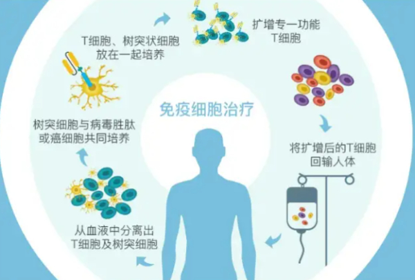 免疫检查点抑制剂和CAR-T疗法_瑞博戴科_祝君健康咨询