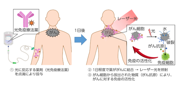 什么是光免疫治疗？其原理是什么？_瑞博戴科_祝君健康咨询