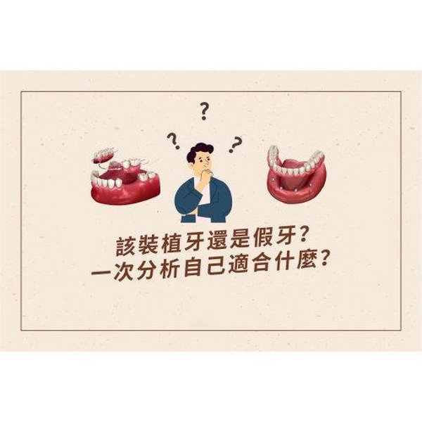 该装假牙还是植牙？一次搞清楚自己要什么-六月微笑口腔