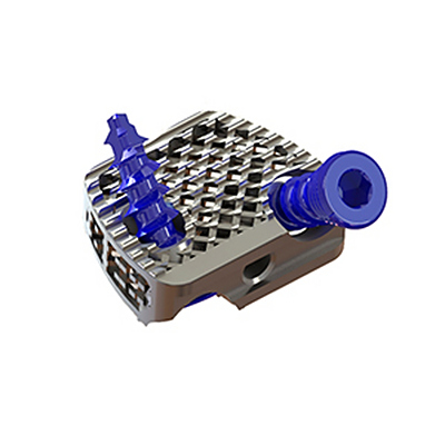 3D打印独立固定融合器