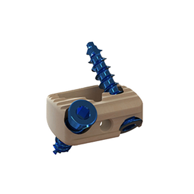 独立固定颈椎融合器