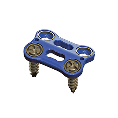 颈椎前路内固定系统（纵向）