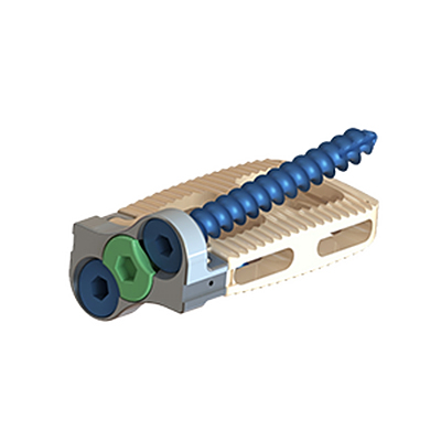 腰椎侧路独立融合器