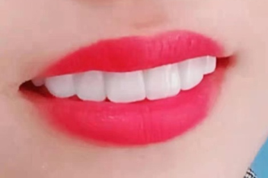 美牙培训课程